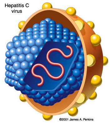 Hepatitis C cure found but costs $84,000